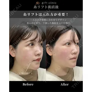 gift clinic 能登谷 翔医師の症例