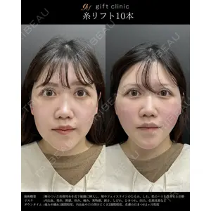 gift clinic 能登谷 翔医師の症例