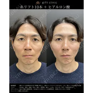 gift clinic 能登谷 翔医師の症例