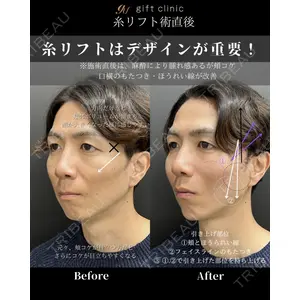 gift clinic 能登谷 翔医師の症例