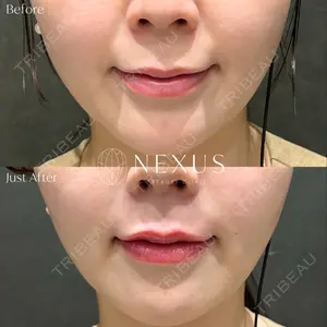 NEXUS CLINIC 河合 朝奈医師の症例