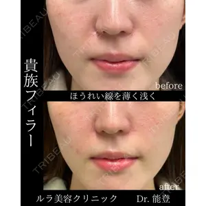 ルラ美容クリニック 新潟院 能登 貴弘医師の症例