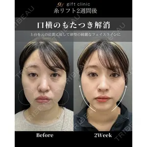gift clinic 能登谷 翔医師の症例