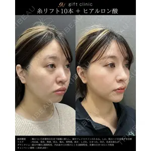 gift clinic 能登谷 翔医師の症例
