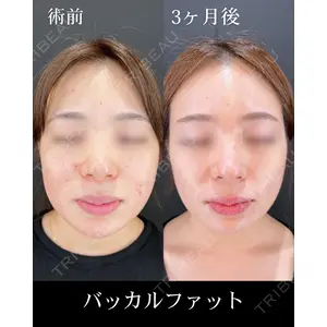 HAAB×DREAM BEAUTY CLINIC 大阪梅田院 柏木 太雅医師の症例
