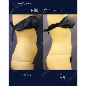 ガーデンクリニック 池袋院の症例