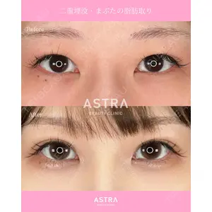 ASTRA BEAUTY CLINIC 河口 はるか医師の症例