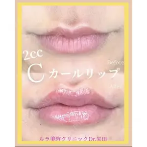 ルラ美容クリニック 京都院 矢田 玲奈医師の症例