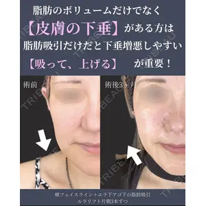 ルラ美容クリニック 京都院 矢田 玲奈医師の症例