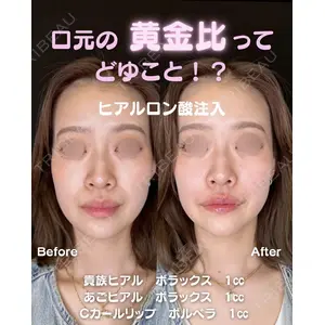 ルラ美容クリニック 京都院 矢田 玲奈医師の症例