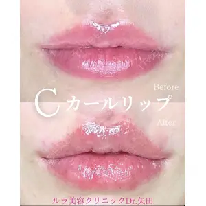 ルラ美容クリニック 京都院 矢田 玲奈医師の症例