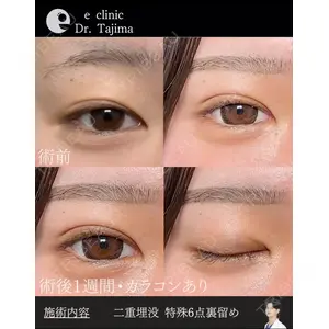 eクリニック 金沢本院 田嶋隼也医師の症例