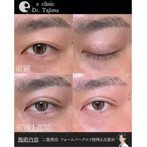 eクリニック 金沢本院 田嶋隼也医師の症例