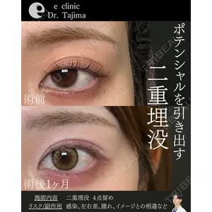 eクリニック 金沢本院 田嶋隼也医師の症例