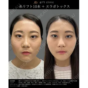 gift clinic 能登谷 翔医師の症例