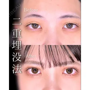 東京シンデレラ美容外科 池袋院 石井 達也医師の症例