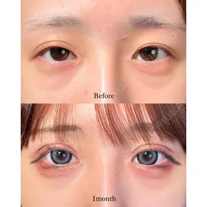 東京シンデレラ美容外科 池袋院の症例