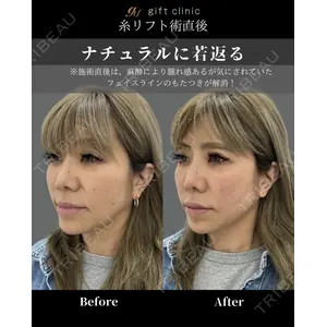 gift clinic 能登谷 翔医師の症例