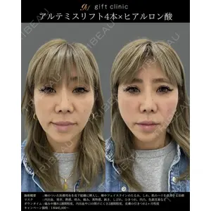 gift clinic 能登谷 翔医師の症例
