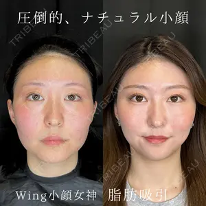 Wing clinic 豊中駅前院 速水 翼医師の症例