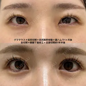エターナル美容クリニック 久門田 詳医師の症例