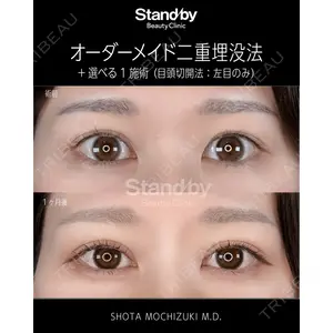 Stand by Beauty Clinic 望月 聖太医師の症例