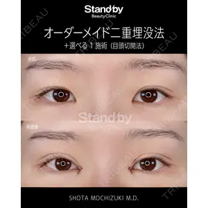 Stand by Beauty Clinic 望月 聖太医師の症例