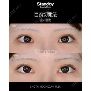 Stand by Beauty Clinic 望月 聖太医師の症例