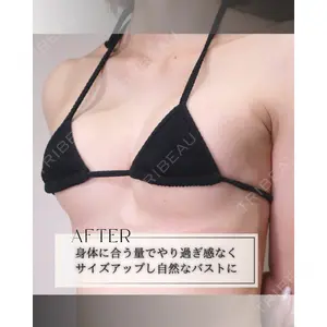 小倉美容外科/美容皮膚科 ビラビューティークリニック 大村 亞蘭医師の症例