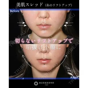 東京形成美容外科 船橋院 山崎 修吾医師の症例
