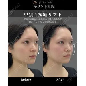 gift clinic 能登谷 翔医師の症例