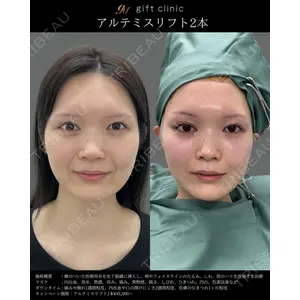gift clinic 能登谷 翔医師の症例