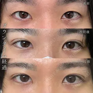 eクリニック 福岡院 伊藤 渉医師の症例