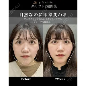 gift clinic 能登谷 翔医師の症例