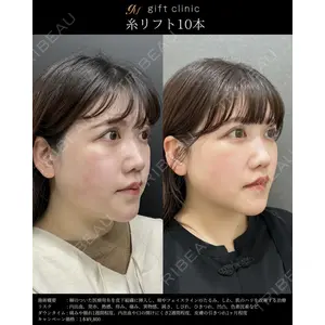 gift clinic 能登谷 翔医師の症例