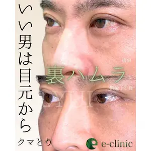 eクリニック 東京院 坂本 優衣医師の症例