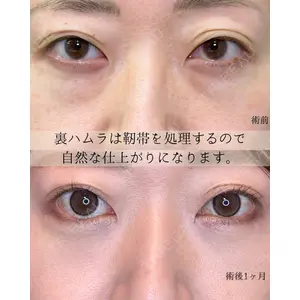 eクリニック 東京院 坂本 優衣医師の症例