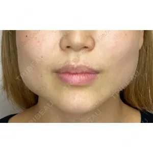 Original Beauty Clinic GINZA 佐藤玲史医師の症例