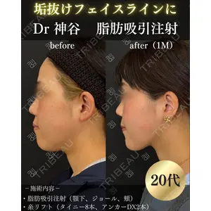 EMMO FACE CLINIC 大阪梅田院 神谷 一成医師の症例