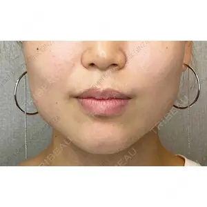 Original Beauty Clinic GINZA 佐藤玲史医師の症例