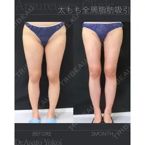 アムルーズ美容外科クリニック 横浜院 横井 麻人医師の症例