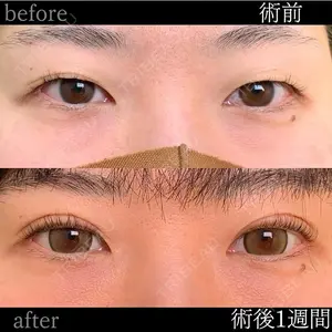 eクリニック 金沢本院 田嶋隼也医師の症例