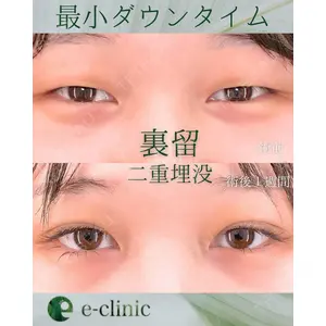 eクリニック 東京院 坂本 優衣医師の症例