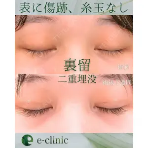 eクリニック 東京院 坂本 優衣医師の症例