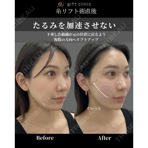 gift clinic 能登谷 翔医師の症例