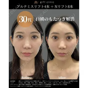gift clinic 能登谷 翔医師の症例