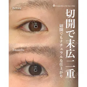 シンデレラ＆ダヴィンチクリニック 宮田 洋佑医師の症例