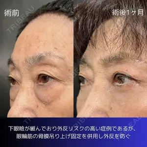 eクリニック 大阪院 八木 良太医師の症例