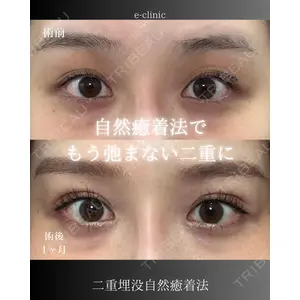 eクリニック 大阪院 八木 良太医師の症例