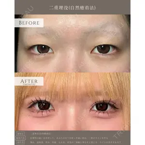 eクリニック 名古屋院 服部 健人医師の症例
